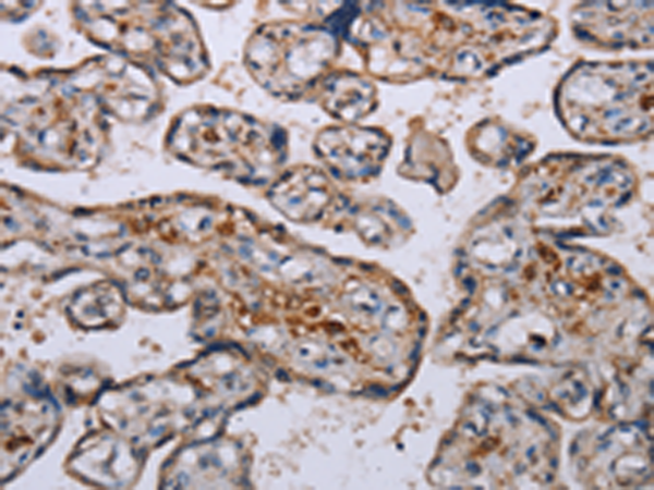 Rabbit Polyclonal Antibody to P3H3