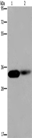LIMS1