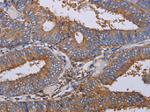 Rabbit Polyclonal Antibody to LIMS1