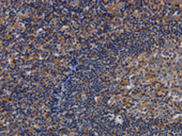 Rabbit Polyclonal Antibody to LIMS1