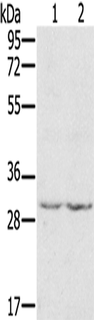 WDR83