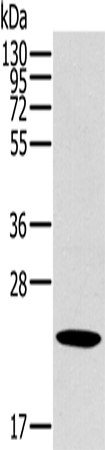 OTUB2