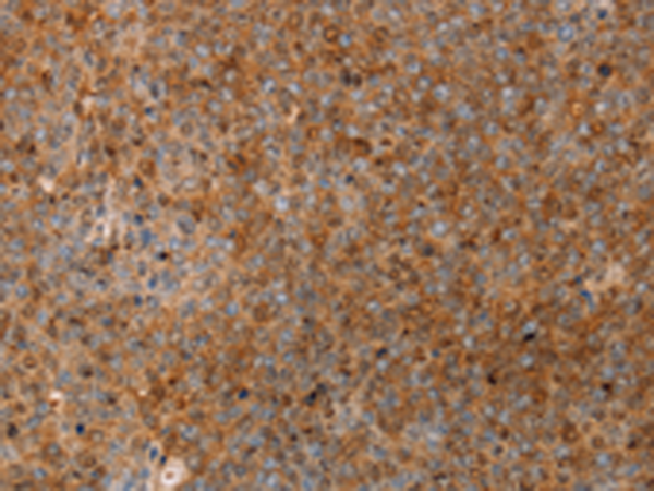 SERPINB2