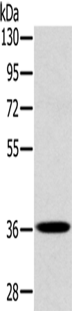 PDLIM1