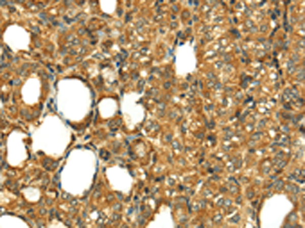 RLN1