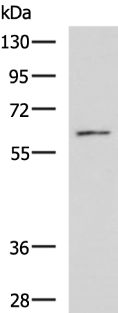 RGS14