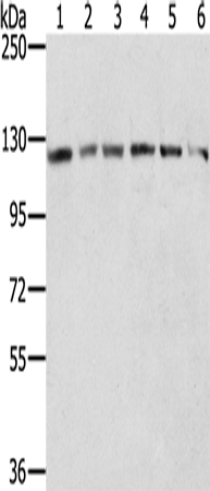 RNF20