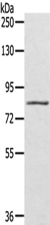 SRPK1