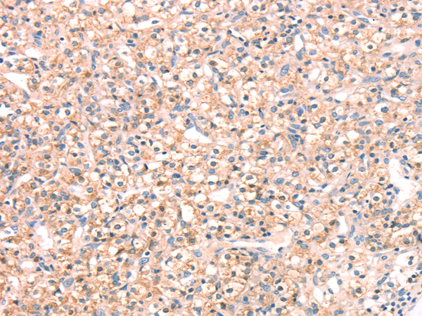 Rabbit Polyclonal Antibody to SNAP23