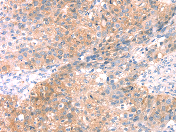 Rabbit Polyclonal Antibody to SNAP23