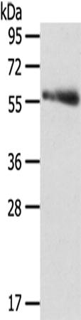 SRPK3