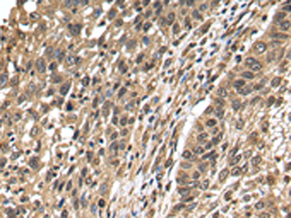 TFDP2