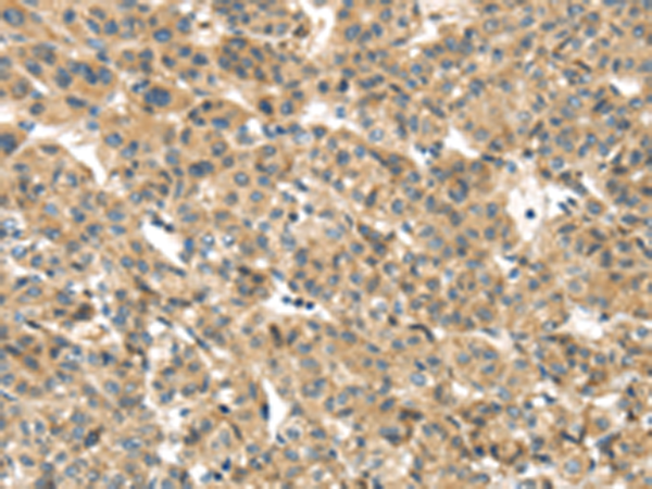 TMEM161A
