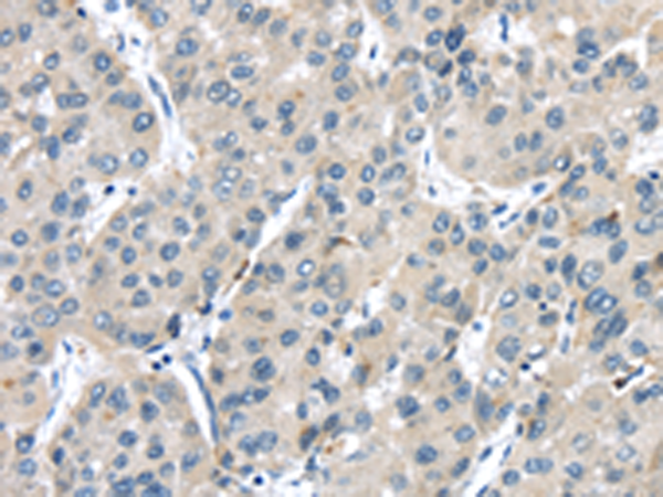 TRPM2