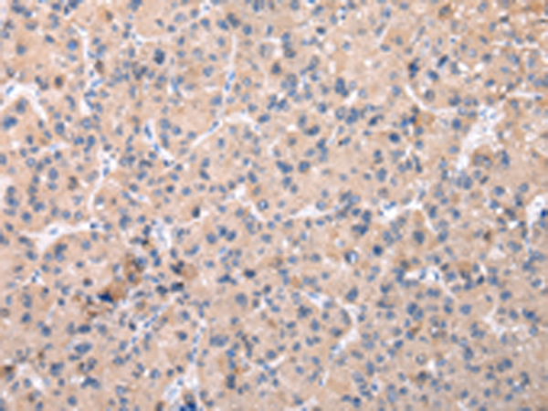 ZNF268