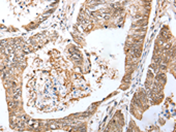 Rabbit Polyclonal Antibody to LRRC19