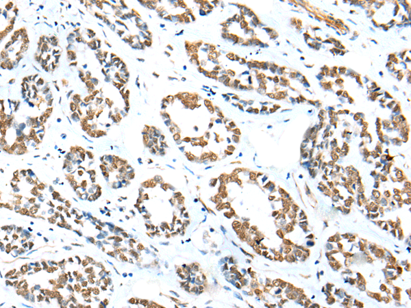 ZNF248