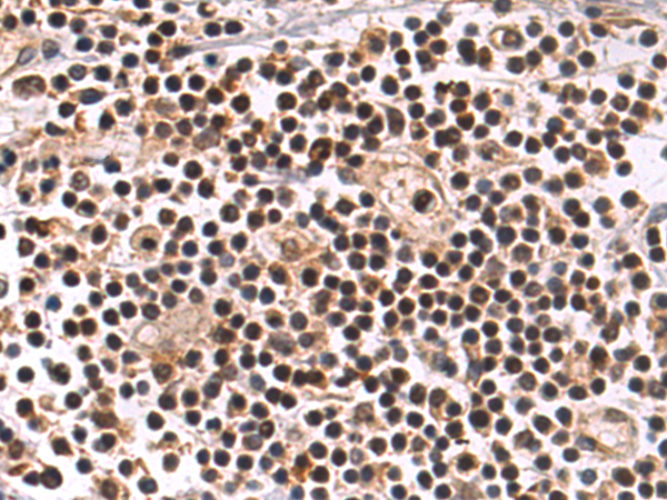 RNF114