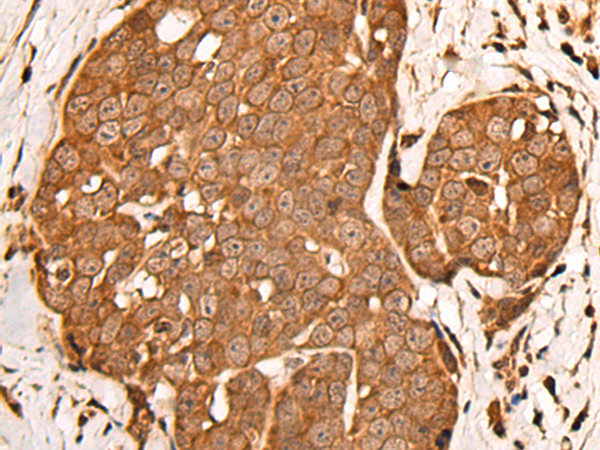 ZPR1