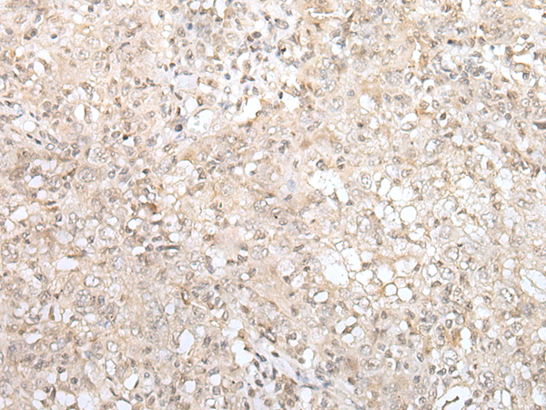 ZNF263