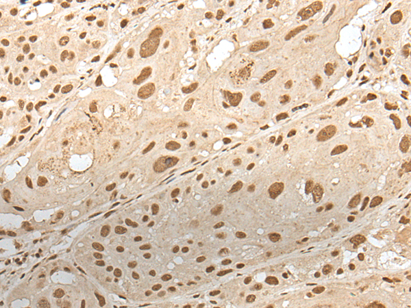 ZNF274