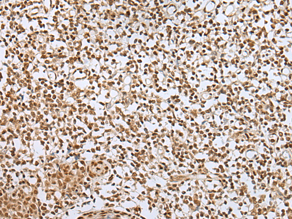 ZNF354A