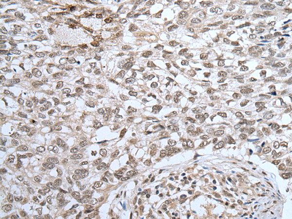 ZNF37A