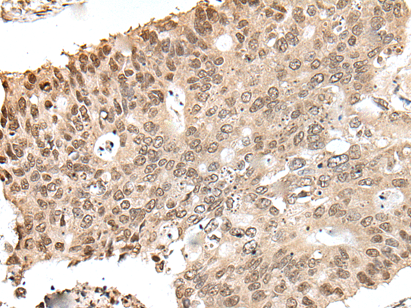 ZNF410