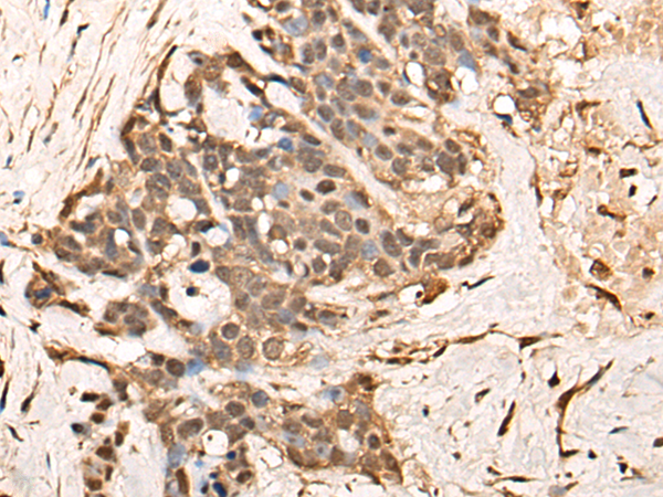 TCEAL9