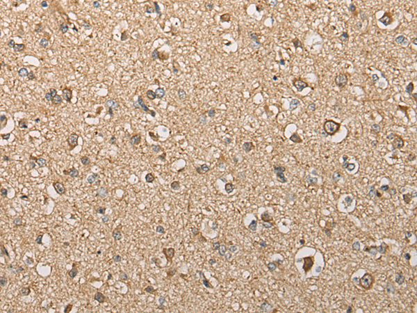 BCO2
