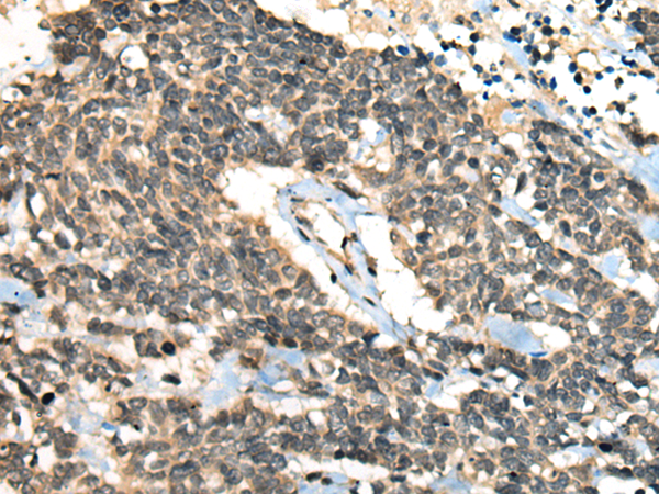 CCNB1IP1