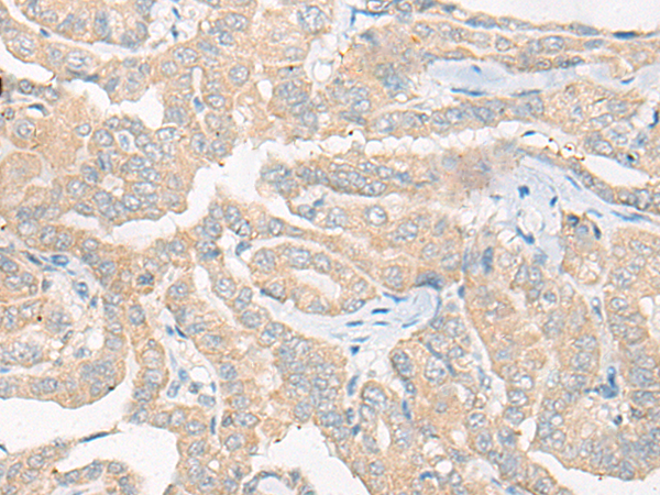 CYFIP1