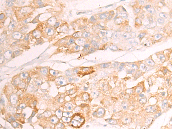 CYP20A1