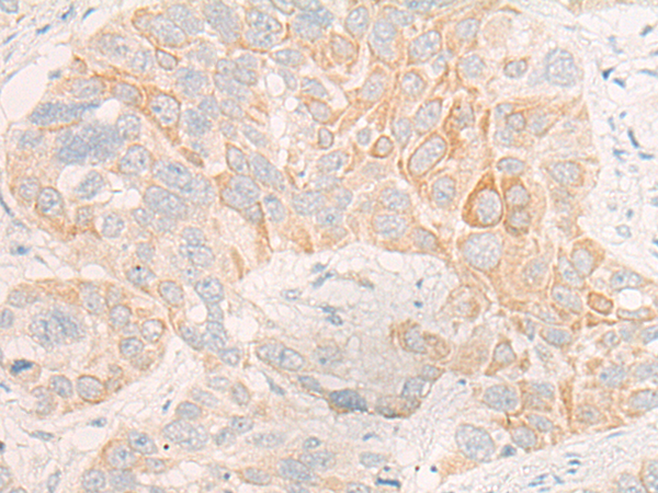 CYP4F12