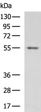 GSDME