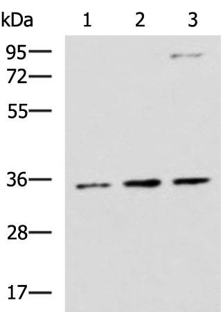 STX5