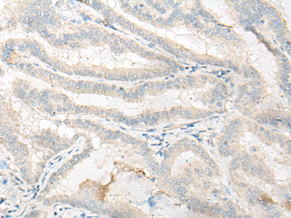 DNASE1L1