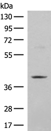 HMG20A