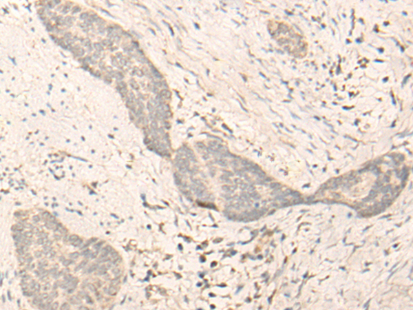 RNF146