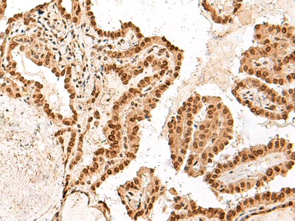 ARMC8