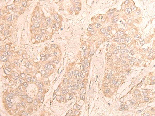 CDK18