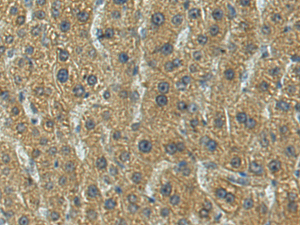 CFAP47