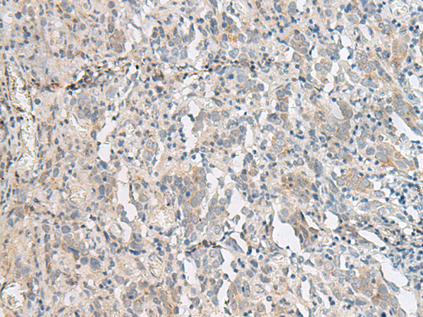 PCSK5
