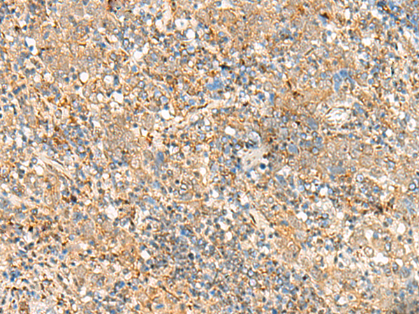 FKBP1A