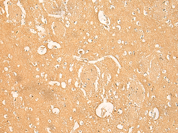 RNASE4