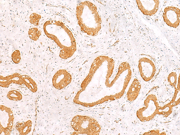PFDN2