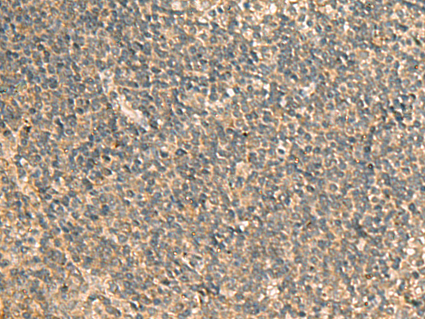 GPBP1