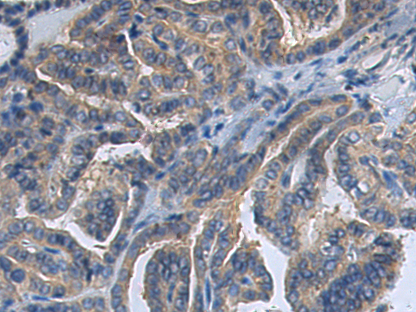 ATP6V1D