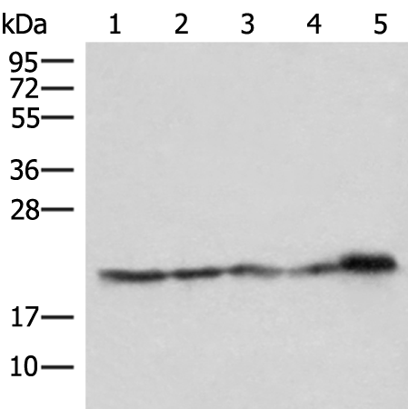ATP5PD