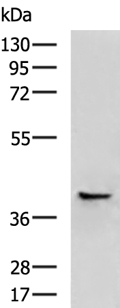 HLA-E